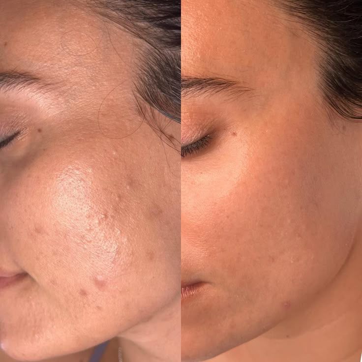 image comparison before